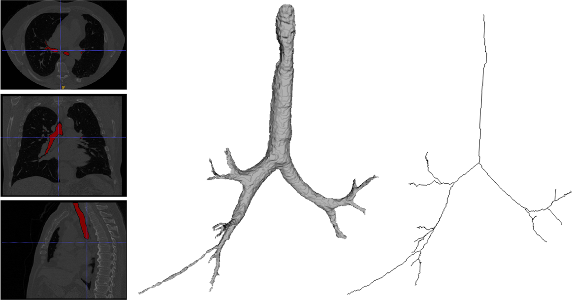 extraction-of-airway-surface-n-centerline-2